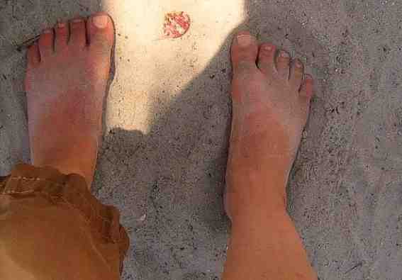 Feet